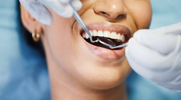 Best Broken or Cracked Tooth Emergency Dentist in Troy, PA